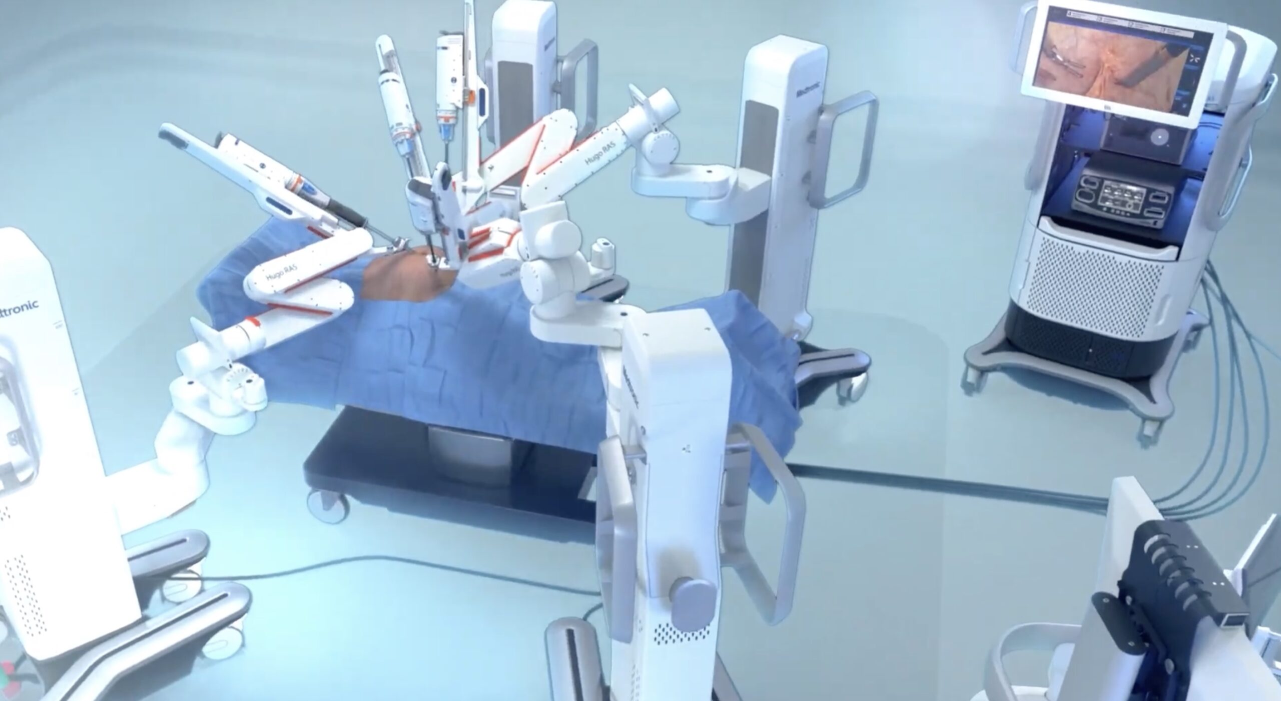 Maternitatea Odobescu din Timișoara, prima intervenţie chirurgicală asistată robotic cu ajutorul noului sistem Medtronic Hugo, la o femeie de 31 de ani cu cancer de col uterin în stadiu avansat