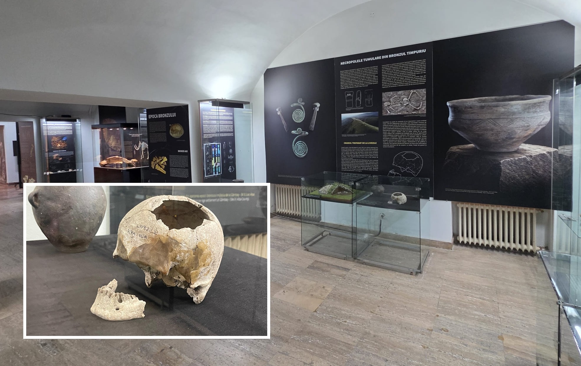 Operație reușită pe creier, veche de 4.500 de ani, în expoziția Muzeului Național al Unirii din Alba Iulia. Craniul trepanat de la Livezile, una dintre cele mai spectaculoase descoperiri preistorice din România. Ce arată studiile antropologice