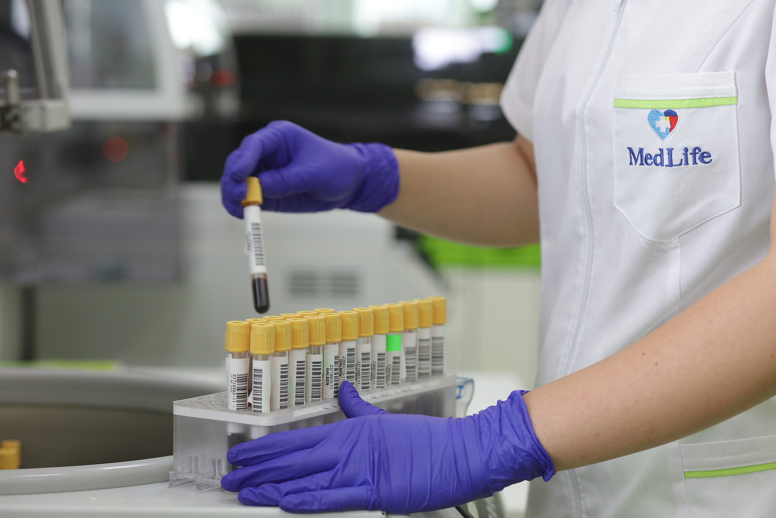 Noua generație de screening prenatal: un simplu test de sânge poate detecta riscul unor anomalii genetice încă din primul trimestru de sarcină