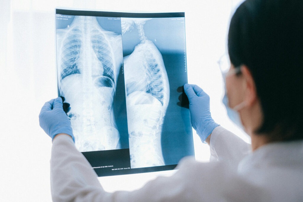 Primul vaccin experimental pentru prevenirea cancerului pulmonar, testat în premieră mondială